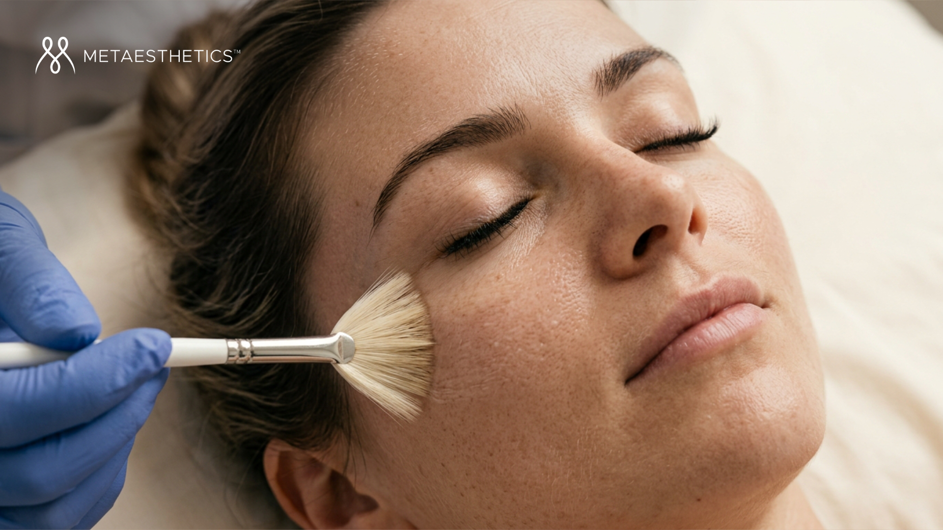 Chemical peel: a complete guide to understanding, choosing and ensuring safe treatment
