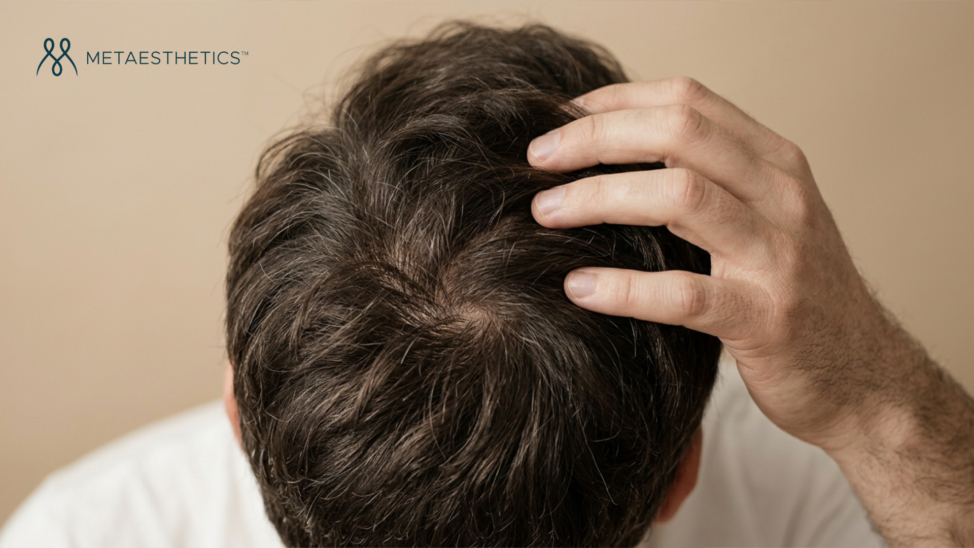 Hair transplant and hair loss treatments: a complete guide